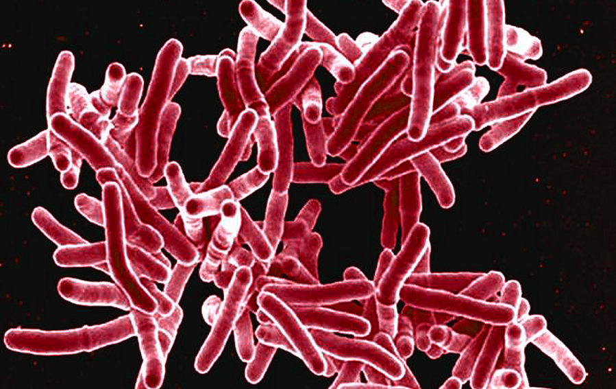 Digitally colorised microscopic image of rod shaped Mycobacterium tuberculosis