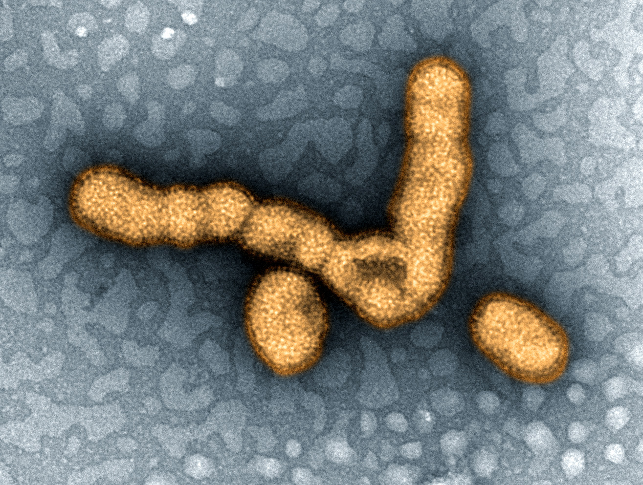 H1 N1 virus