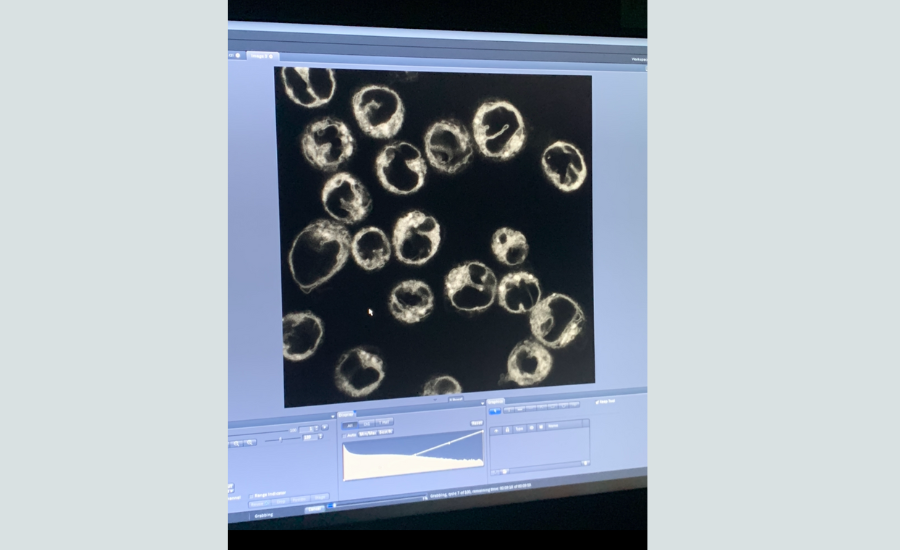 Computer screen showing cell images