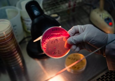 A lab scientist holds a culture dish containing Vibrio Cholerae