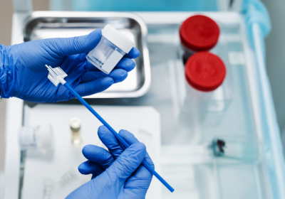 Gynaecologist holds a cervical swab in gloved hands