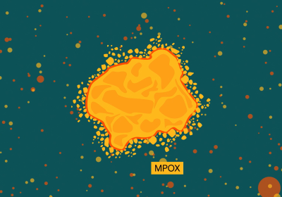 Graphic representation of mpox virus. Credit: LSHTM.