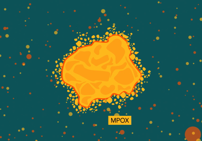 Graphic representation of mpox virus structure. Credit: LSHTM.