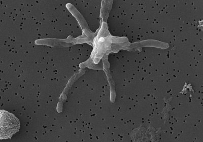 M. tuberculosis micrograph courtesy of Dr Clara Aguilar Pérez