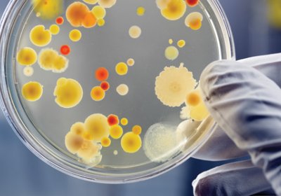 A Scientist holding  a petri dish containing a variety of  microbial colonies