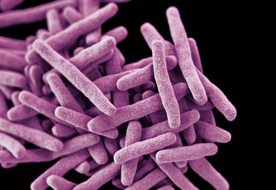 3D computer-generated image of a cluster of rod shaped drug-resistant Mycobacterium tuberculosis bacteria