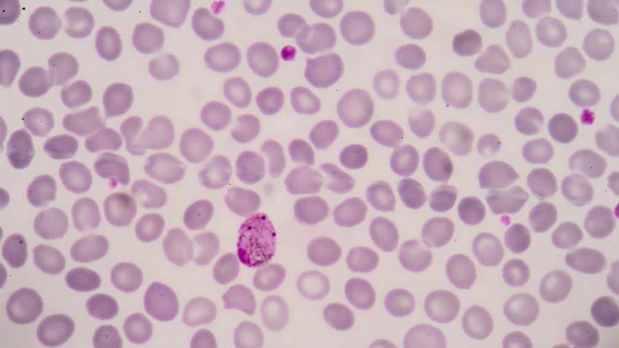 Malaria vaccine: Not perfect but life-saving | LSHTM