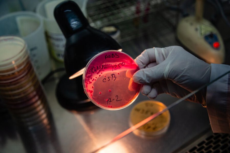 A lab scientist holds a culture dish containing Vibrio Cholerae