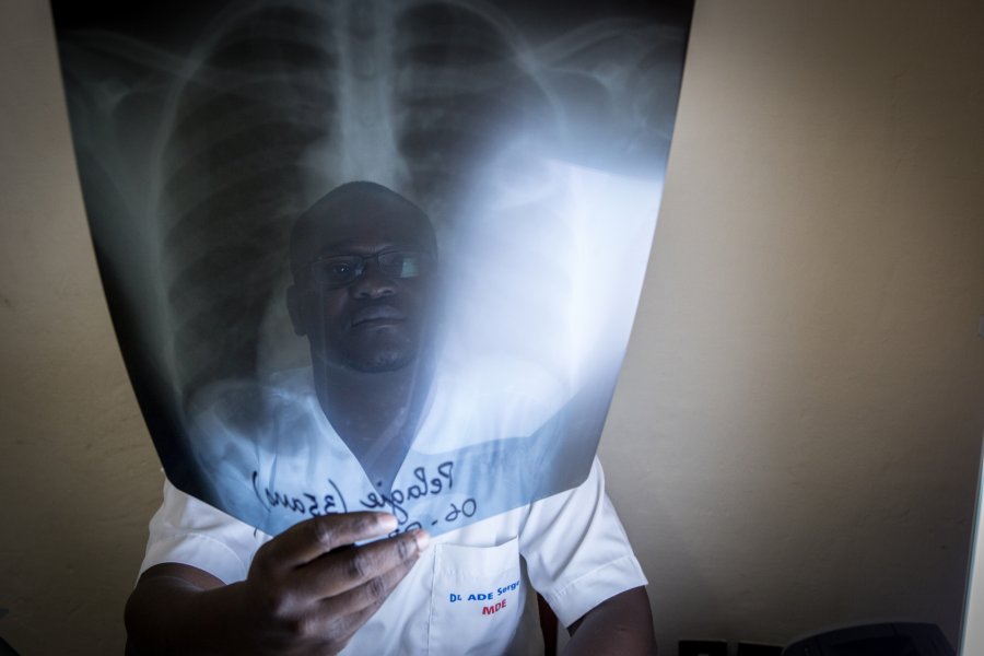 Caption: man holding lung x-ray. Credit: the Union