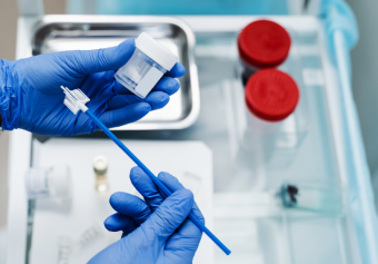 Gynaecologist holds a cervical swab in gloved hands