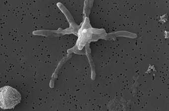 M. tuberculosis micrograph courtesy of Dr Clara Aguilar Pérez